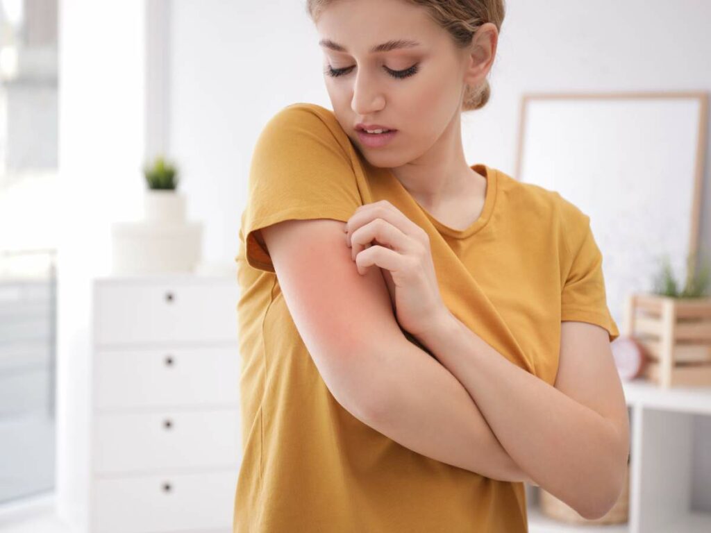 A person wearing a yellow shirt scratches a red irritated area on their upper arm. The background includes white furniture and a potted plant.